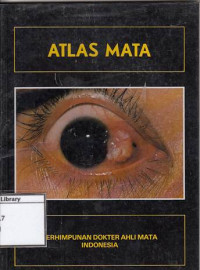Image of Atlas Mata